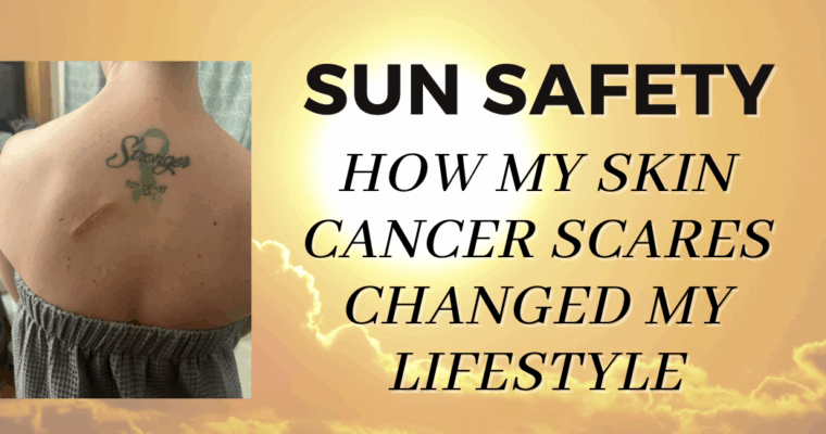 Sun Safety: How my Skin Cancer Scares changed my lifestyle