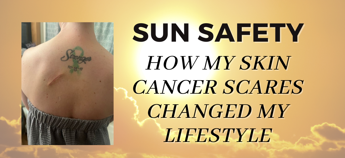 Sun Safety: How my Skin Cancer Scares changed my lifestyle